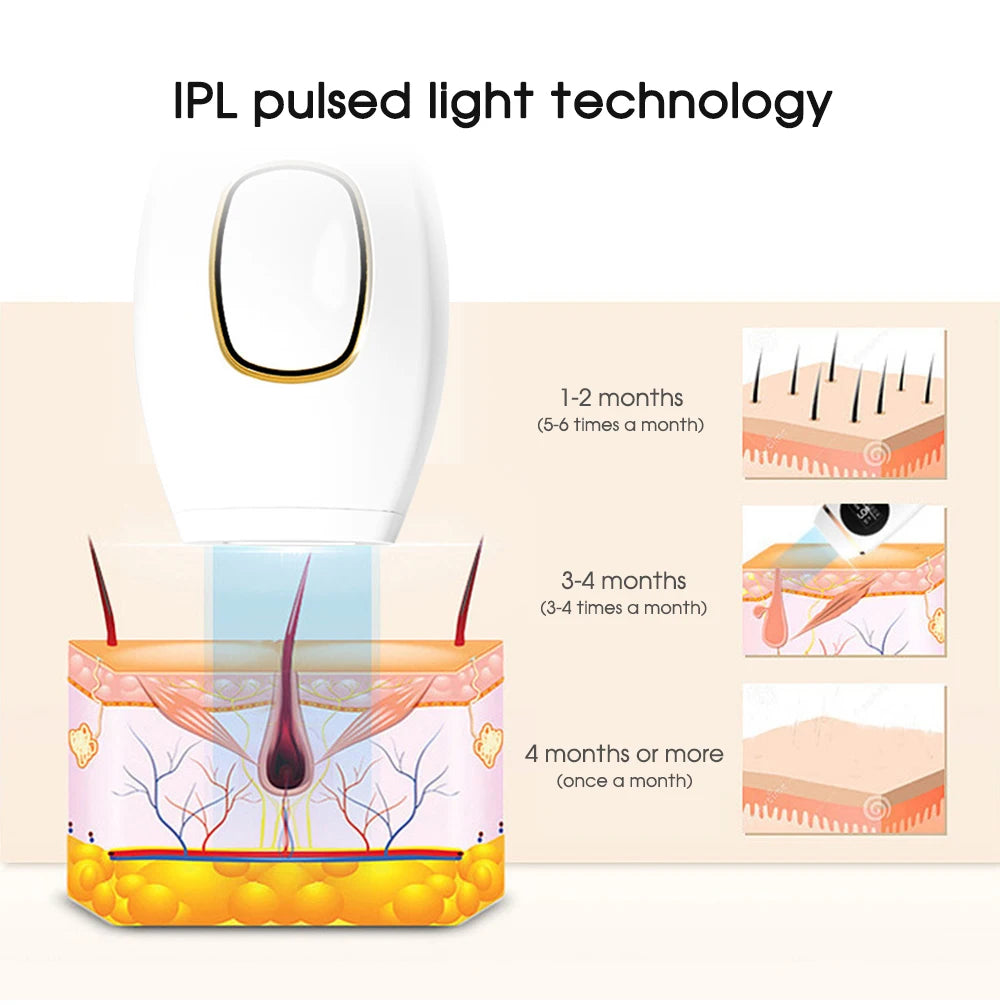 DEPILADORA LASER IPL